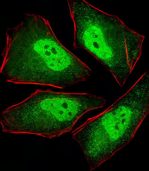 PSMA5 Antibody in Immunocytochemistry (ICC/IF)