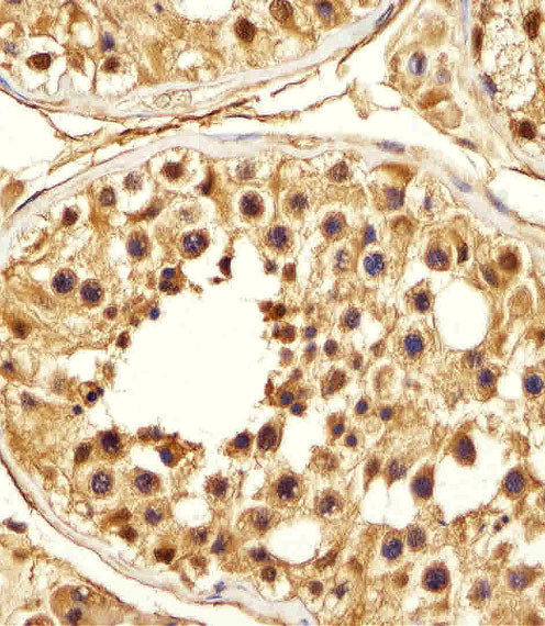 PSMA5 Antibody in Immunohistochemistry (Paraffin) (IHC (P))