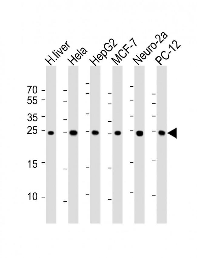 PSMA5 Antibody in Western Blot (WB)