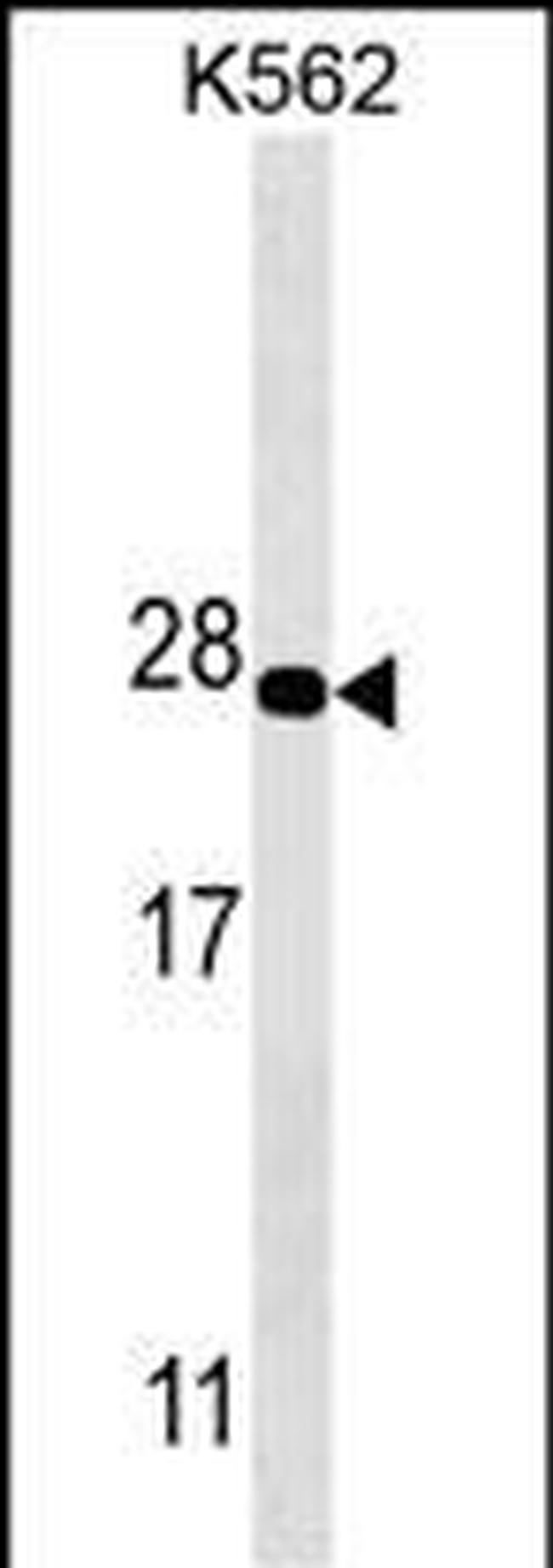 PSMA5 Antibody in Western Blot (WB)