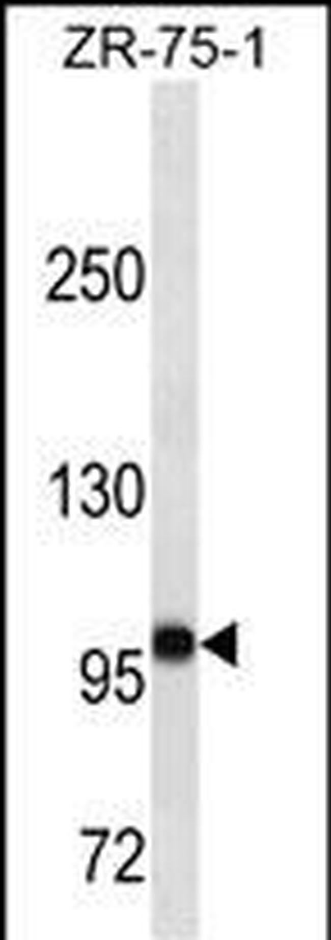 FUT4 Antibody in Western Blot (WB)