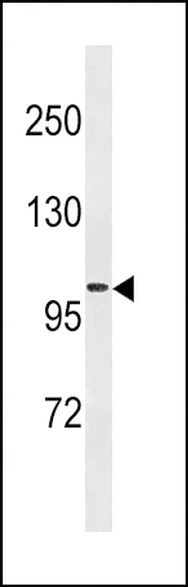 Fibrinogen alpha chain Antibody in Western Blot (WB)