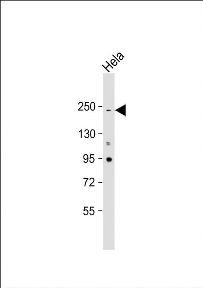 NOTCH3 Antibody in Western Blot (WB)