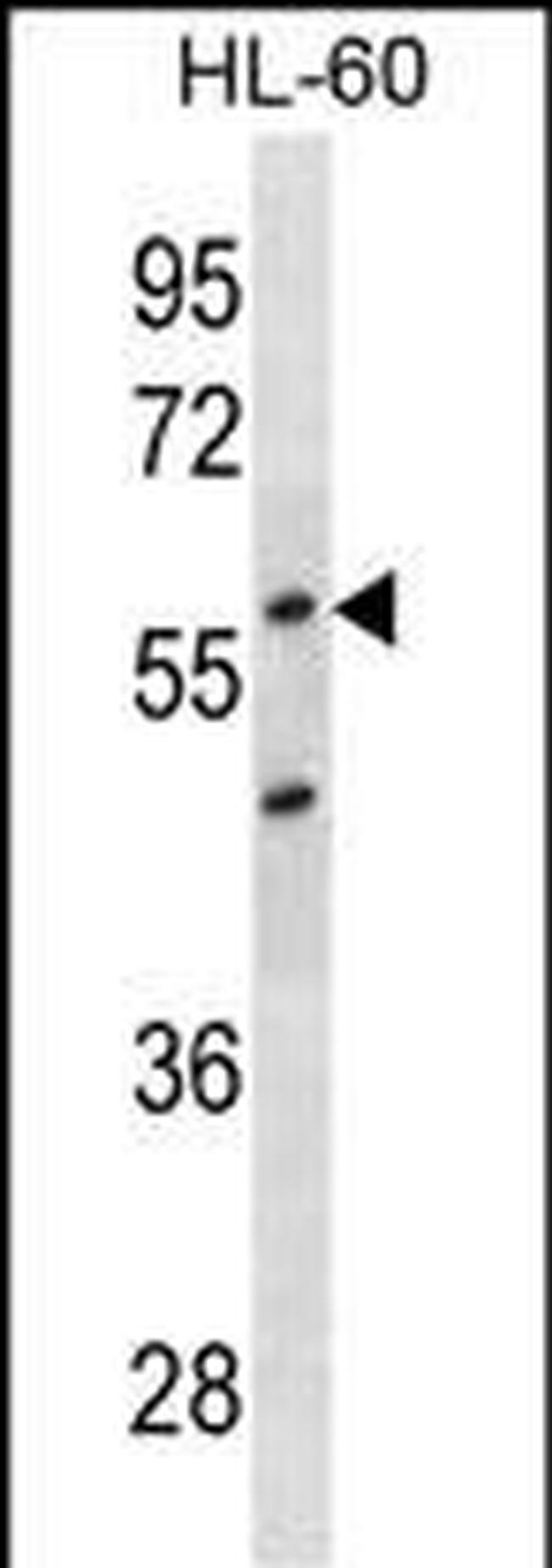 p57 Kip2 Antibody in Western Blot (WB)