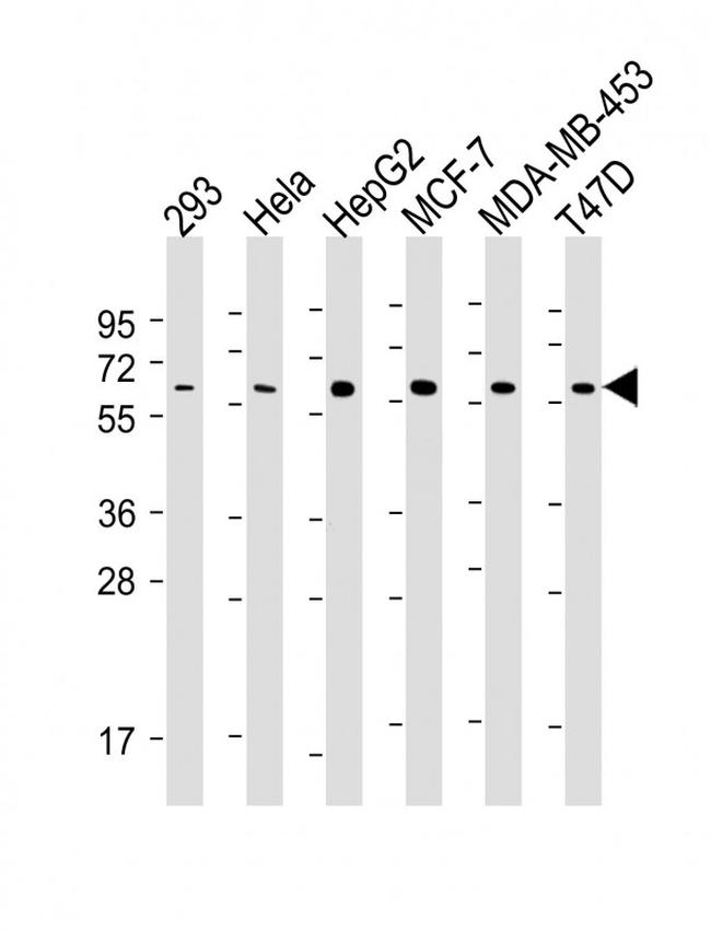 VDR Antibody in Western Blot (WB)