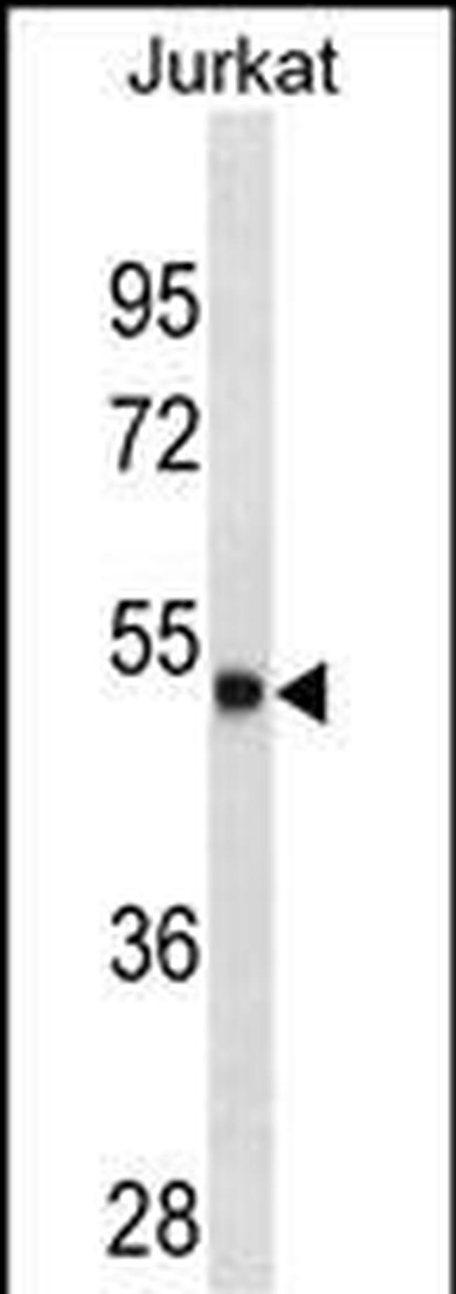 Arylsulfatase A Antibody in Western Blot (WB)