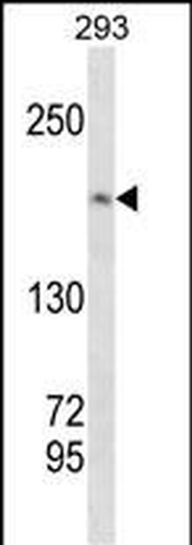 TOP2A Antibody in Western Blot (WB)