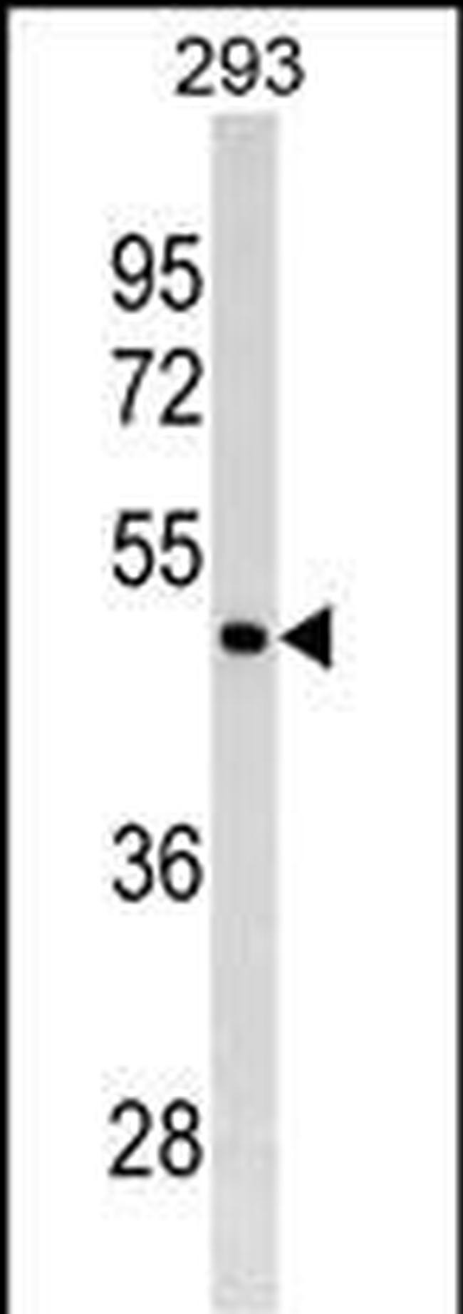 GATA4 Antibody in Western Blot (WB)