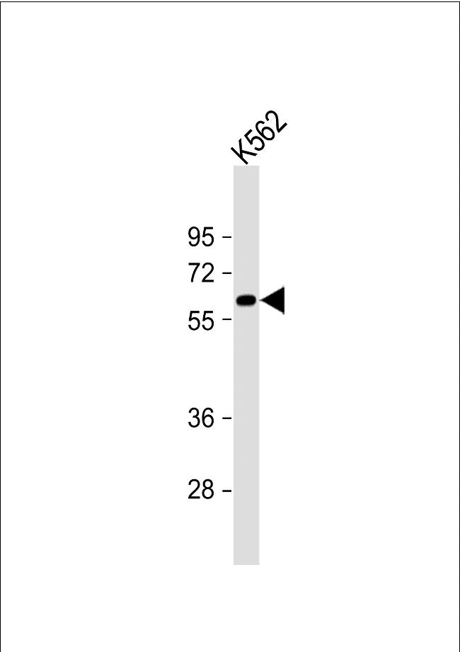 Catalase Antibody in Western Blot (WB)