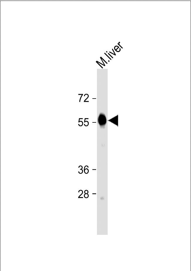 Catalase Antibody in Western Blot (WB)