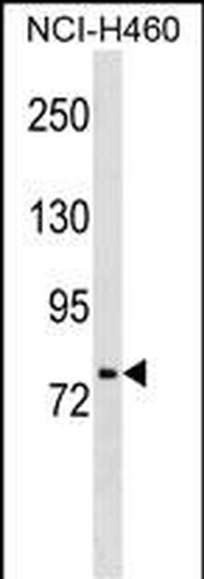 HNF1A Antibody in Western Blot (WB)