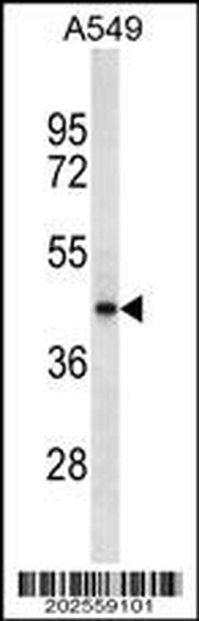 Tecrl Antibody in Western Blot (WB)