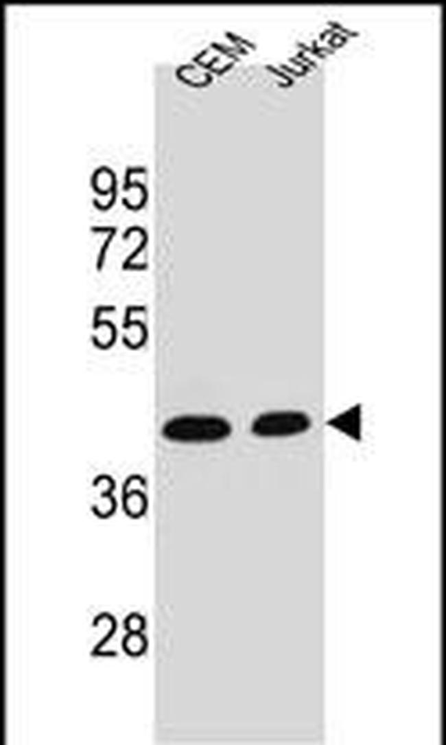 Adenosine Deaminase Antibody in Western Blot (WB)