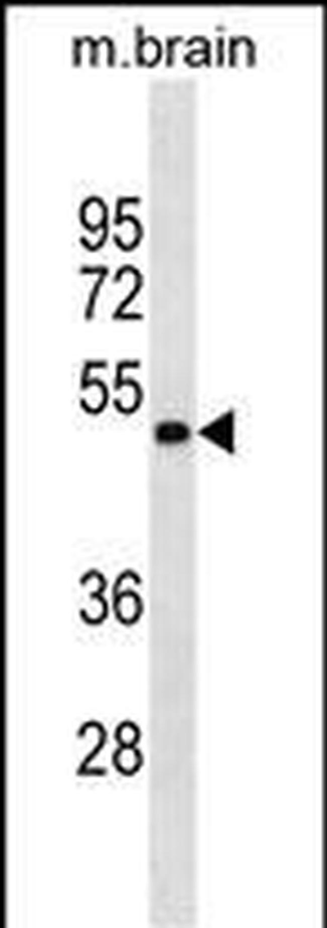 GNAS Antibody in Western Blot (WB)