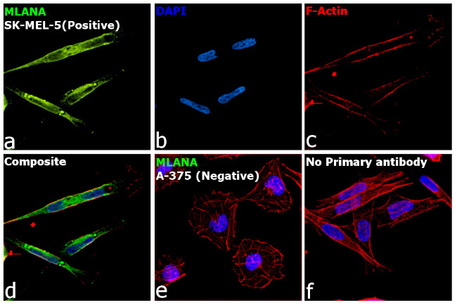 Melan-A Antibody in Immunocytochemistry (ICC/IF)