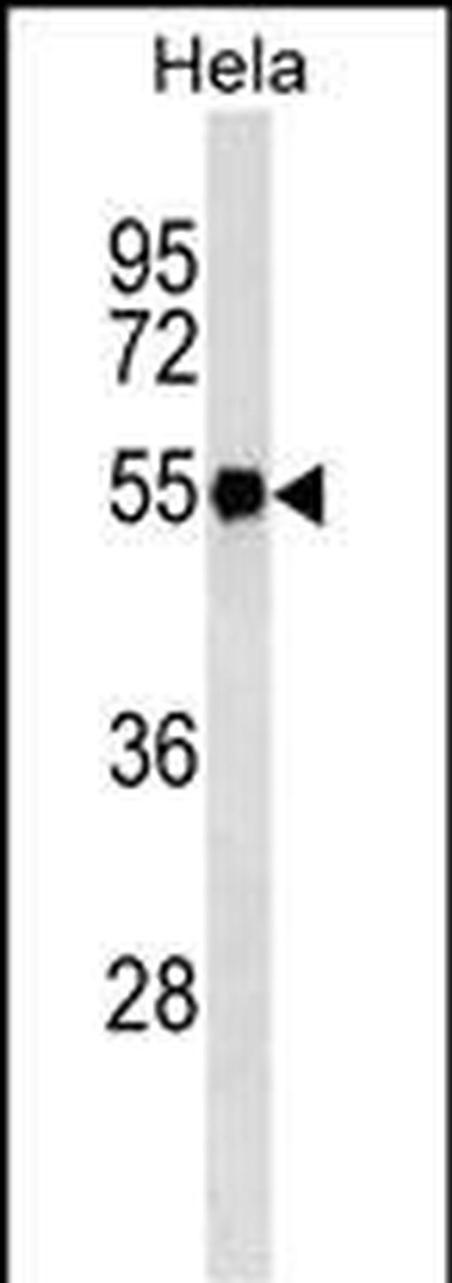 Fibrinogen gamma Antibody in Western Blot (WB)