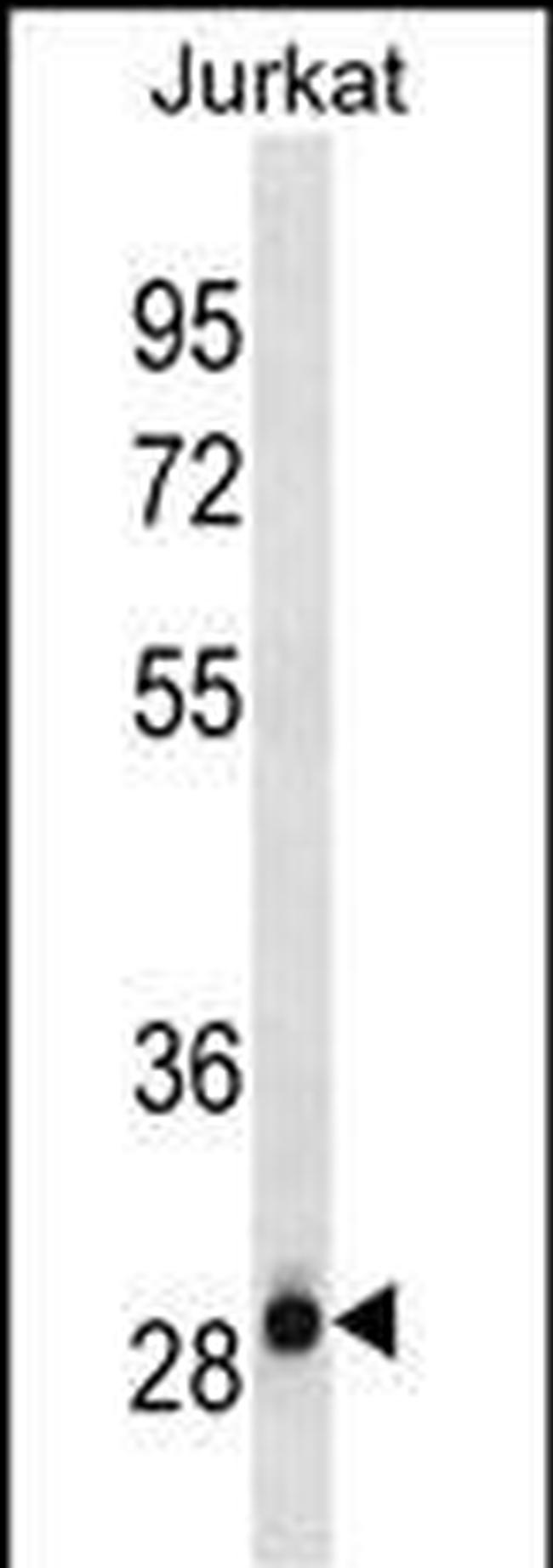 HAGH Antibody in Western Blot (WB)