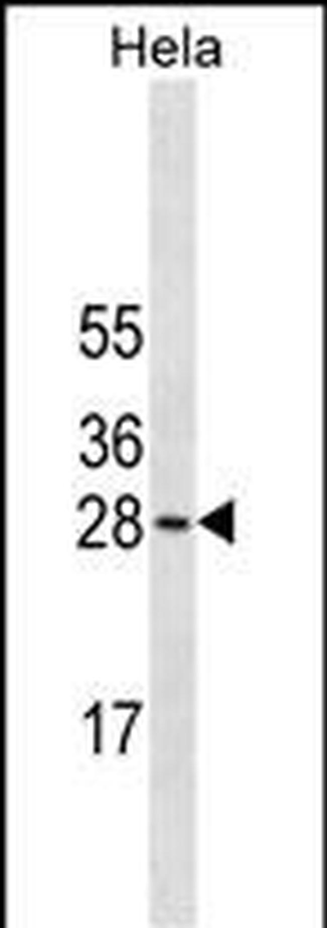 COMT Antibody in Western Blot (WB)