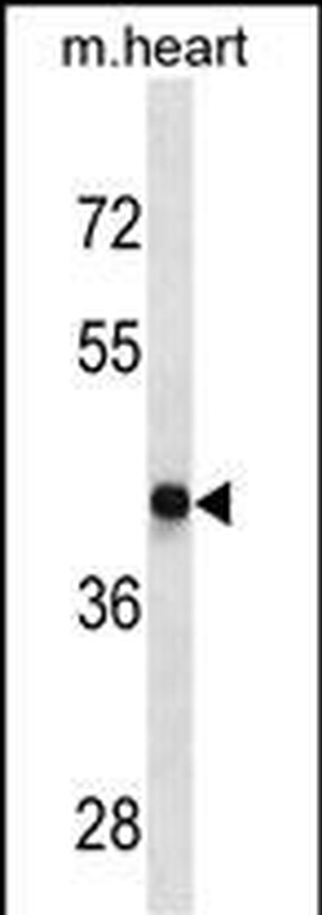 D4 Dopamine Receptor Antibody in Western Blot (WB)