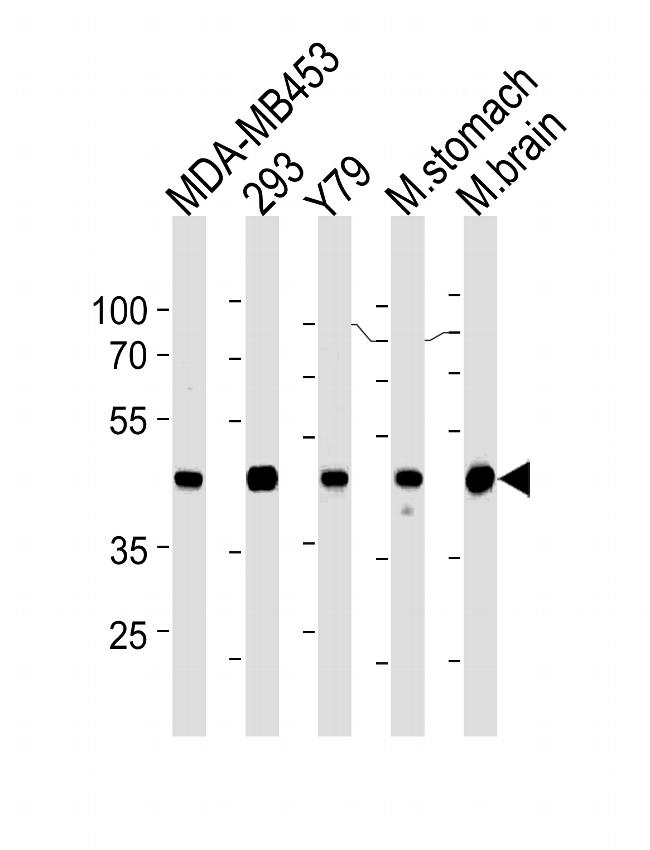 Creatine Kinase BB Antibody in Western Blot (WB)