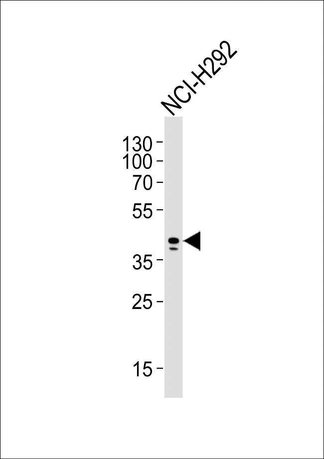 AIM2 Antibody in Western Blot (WB)