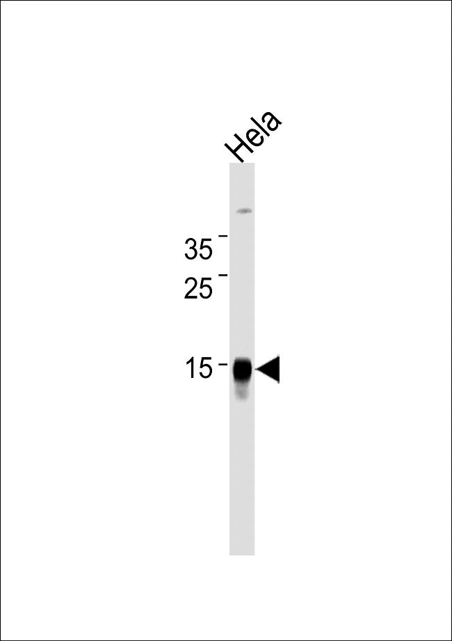 CDA Antibody in Western Blot (WB)