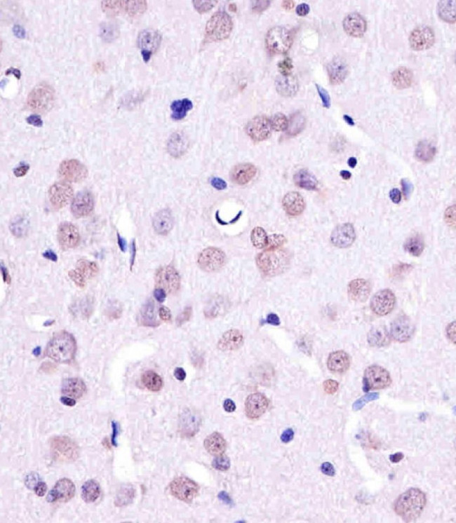 YY1 Antibody in Immunohistochemistry (Paraffin) (IHC (P))