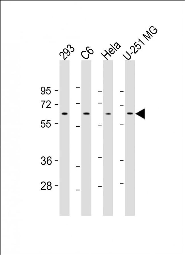 YY1 Antibody in Western Blot (WB)