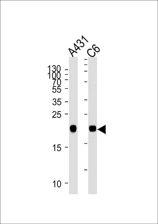 N-Ras Antibody in Western Blot (WB)