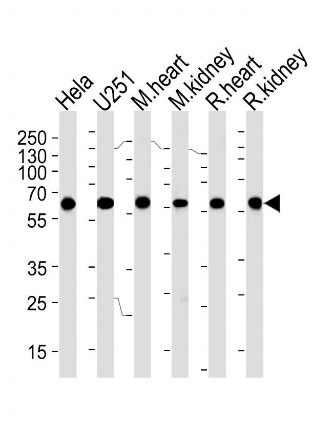 BBS4 Antibody in Western Blot (WB)