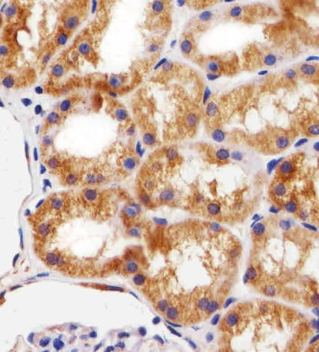 Bcl-10 Antibody in Immunohistochemistry (Paraffin) (IHC (P))