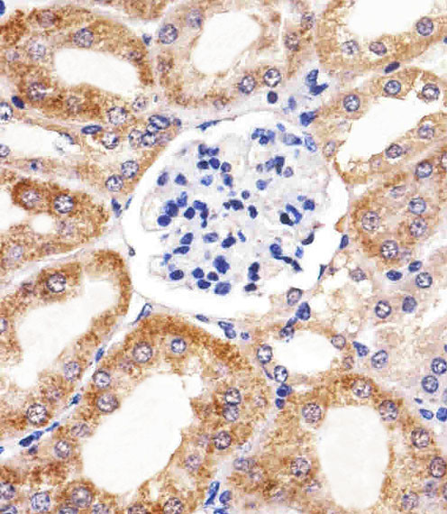 Bcl-10 Antibody in Immunohistochemistry (Paraffin) (IHC (P))