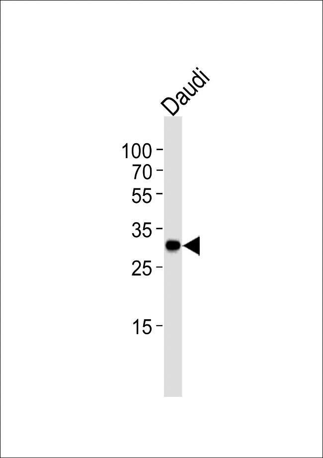 Bcl-10 Antibody in Western Blot (WB)