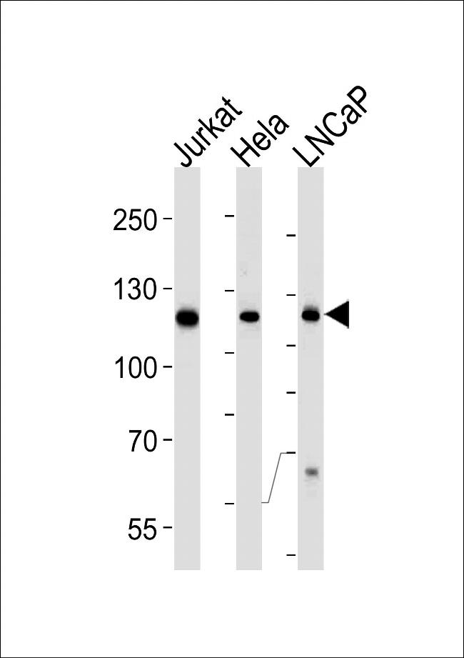 USP11 Antibody in Western Blot (WB)