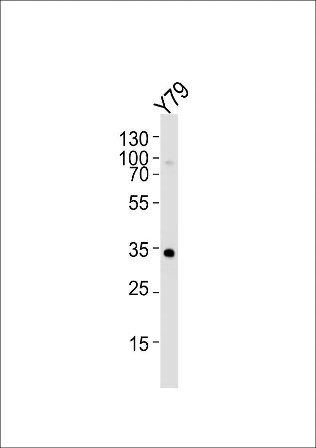 OTX2 Antibody in Western Blot (WB)