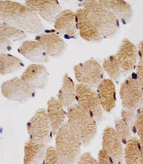 p27 Kip1 Antibody in Immunohistochemistry (Paraffin) (IHC (P))