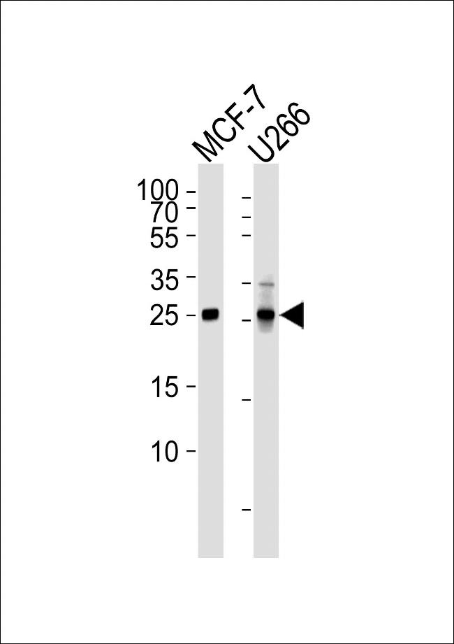 p27 Kip1 Antibody in Western Blot (WB)