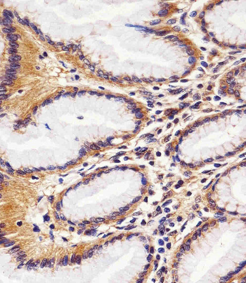 RAC1 Antibody in Immunohistochemistry (Paraffin) (IHC (P))