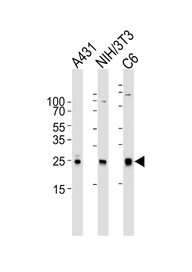 RAC1 Antibody in Western Blot (WB)