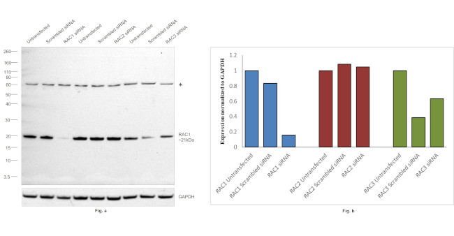 RAC1 Antibody in Western Blot (WB)