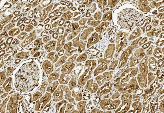 ULK3 Antibody in Immunohistochemistry (Paraffin) (IHC (P))