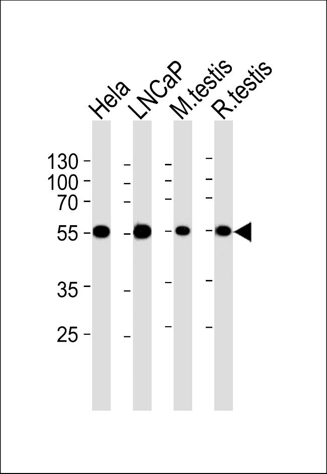 ULK3 Antibody in Western Blot (WB)