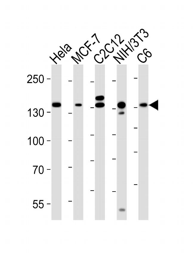 Raptor Antibody in Western Blot (WB)