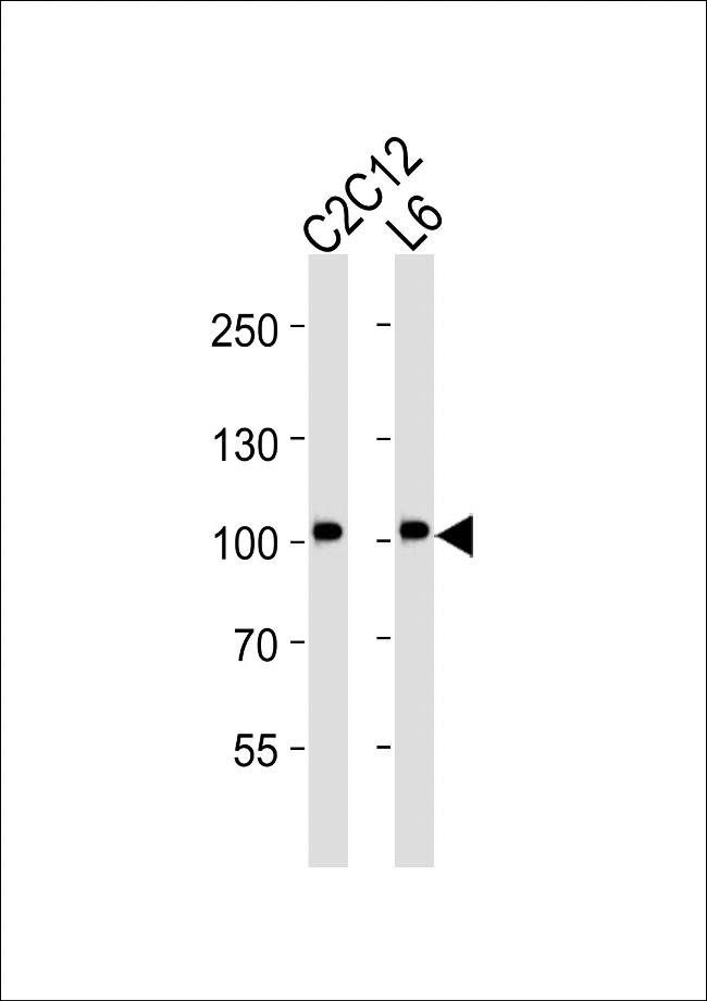 MUSK Antibody in Western Blot (WB)