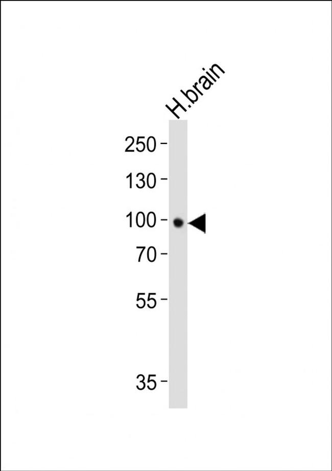 TrkB Antibody in Western Blot (WB)