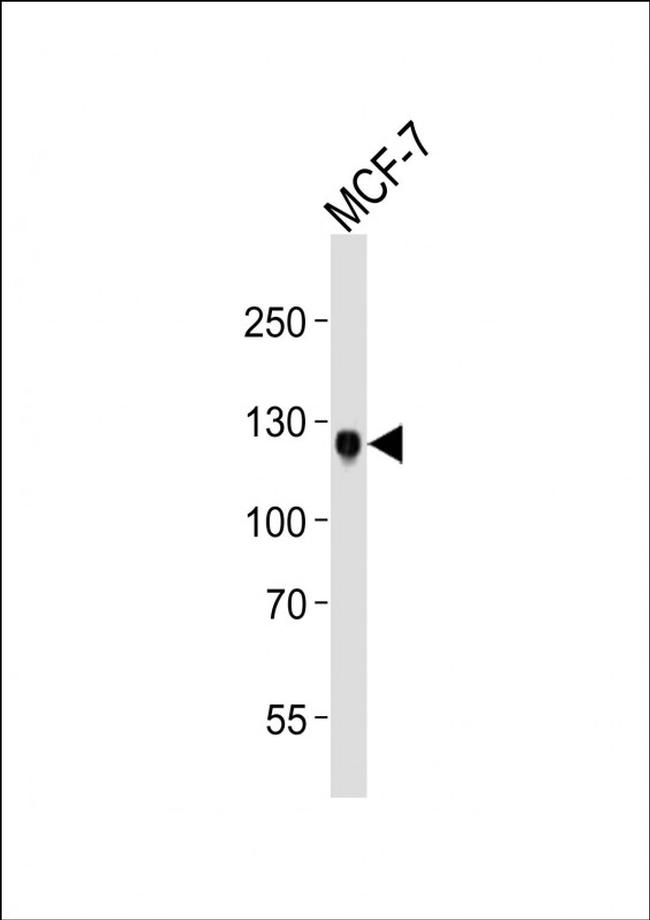 MCK10 Antibody in Western Blot (WB)