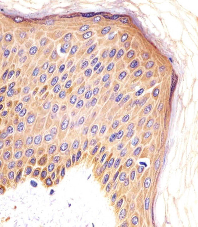 CSF1R Antibody in Immunohistochemistry (Paraffin) (IHC (P))