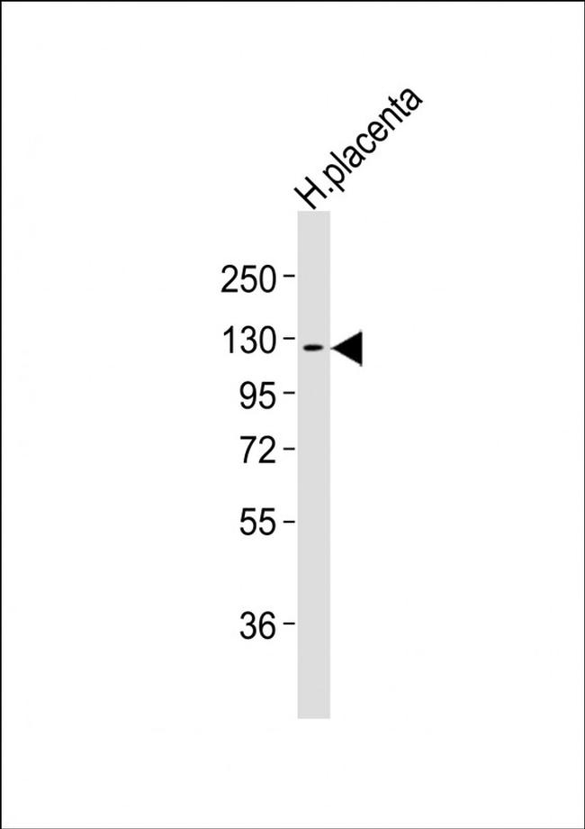 CSF1R Antibody in Western Blot (WB)