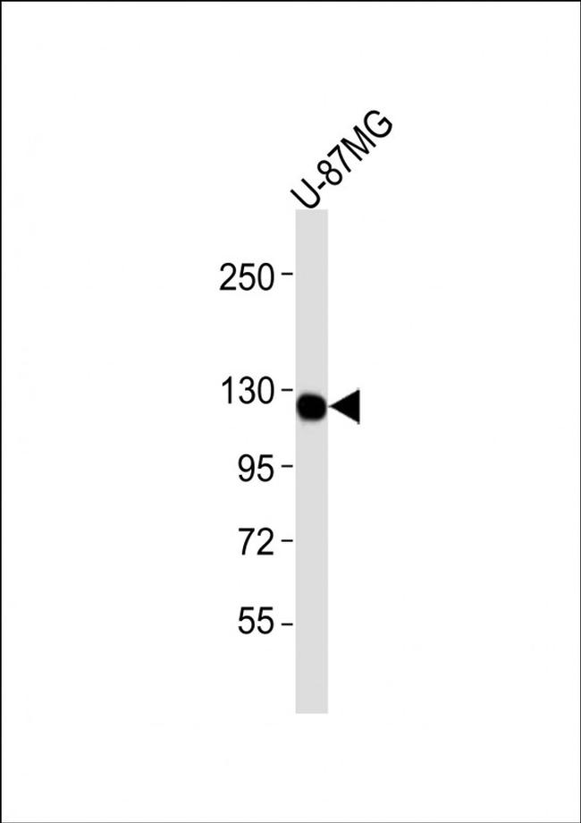 CSF1R Antibody in Western Blot (WB)