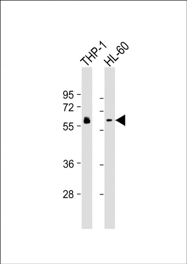 HCK Antibody in Western Blot (WB)